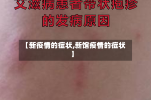 【新疫情的症状,新馆疫情的症状】