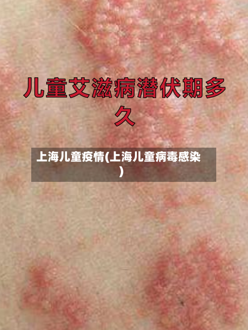 上海儿童疫情(上海儿童病毒感染)-第1张图片