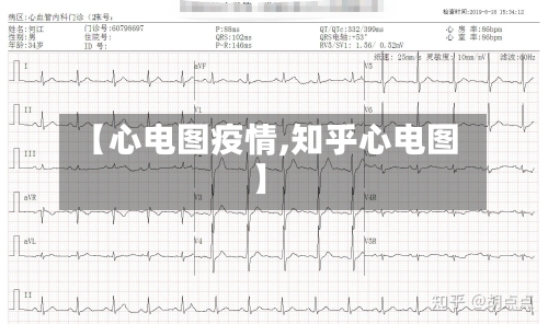 【心电图疫情,知乎心电图】-第2张图片