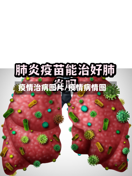 疫情治病图片/疫情病情图-第1张图片